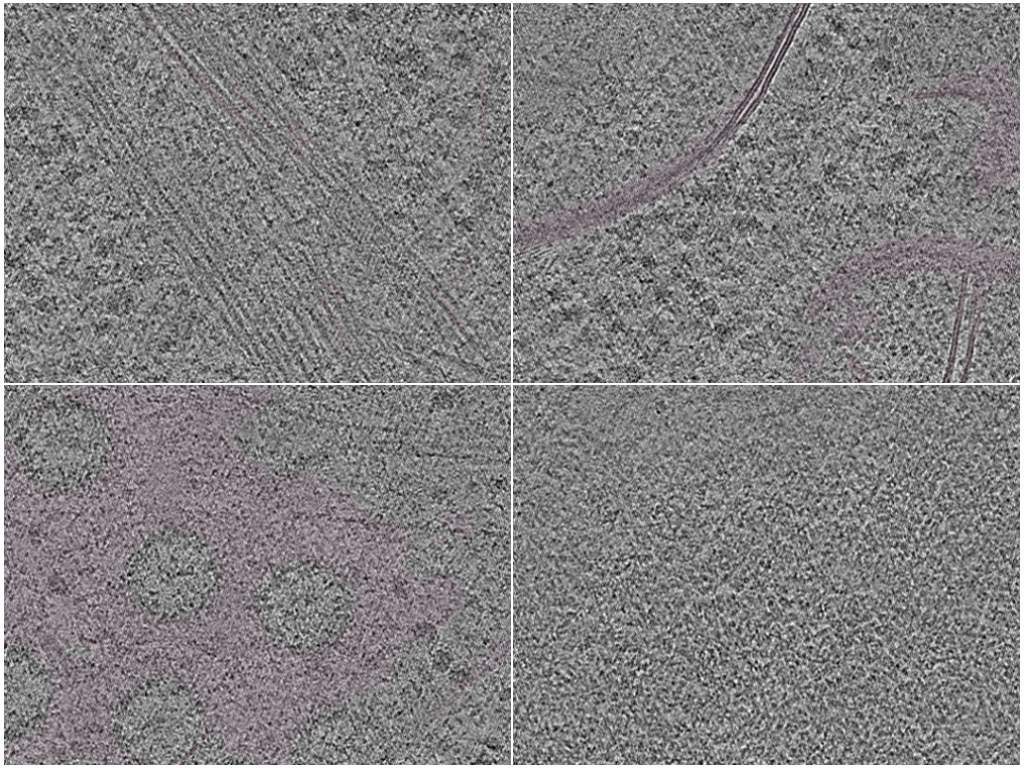 key visualization for In situ cryo-electron tomography of NIH/3T3 mouse fibroblast nuclei