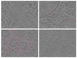 key visualization for In situ cryo-electron tomography of NIH/3T3 mouse fibroblast nuclei
