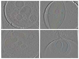 key visualization for Refined organelle segmentations of axonal varicosity tomograms