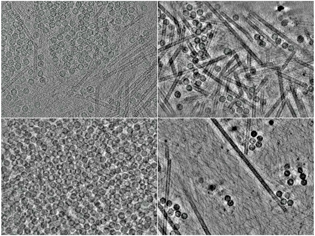 key visualization for Refined tilt-series alignments and post-processed tomograms for xLPP cryoET of PP7 virus-like particles in E. coli